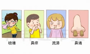 过敏性鼻炎