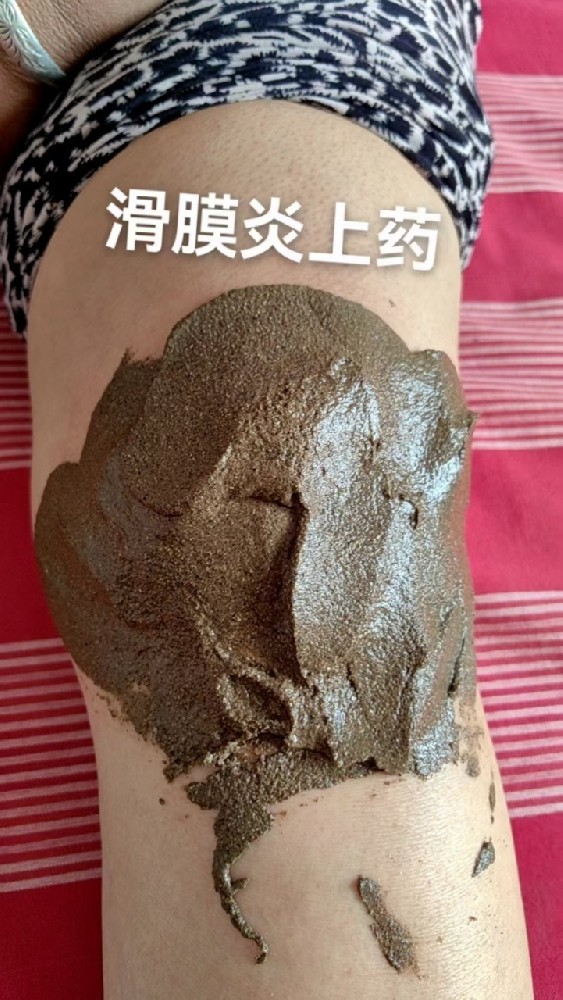 专治滑膜炎积液验方，百发百中